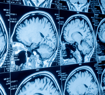 Imaging of the brain